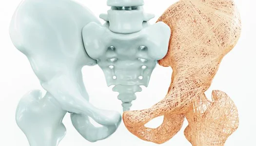 Osteoporose & Metabolismo Ósseo - Amme Endocrinologia Palmas