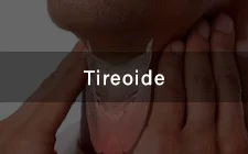 Tratamento da Tireoide